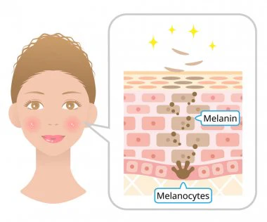 pigmentation